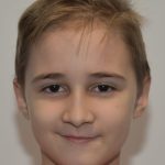 Pleša Leon